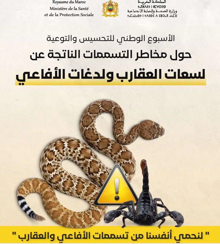 Au Maroc, 25.000 piqûres de scorpions et 250 morsures de serpents chaque année Au Maroc, 25.000 piqûres de scorpions et 250 morsures de serpents chaque année