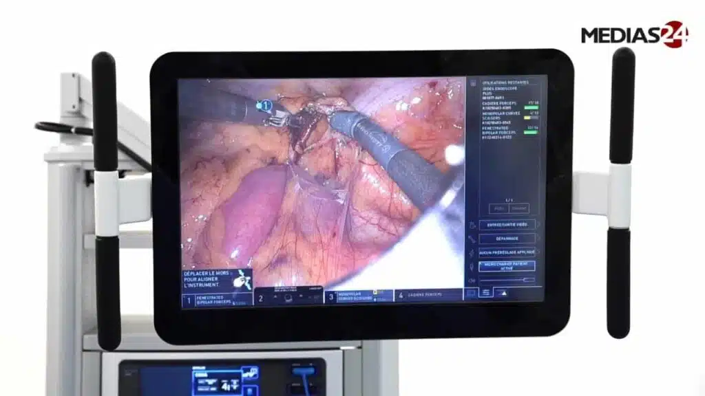 Casablanca : succès de la première intervention chirurgicale viscérale robotique chez la FM6SS Robotique CHeikh Khalifa