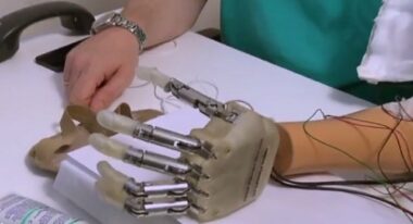 Une main bionique permet aux amputés de retrouver la sensation du toucher