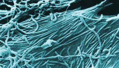 Ebola, visite guidée du service d’isolement