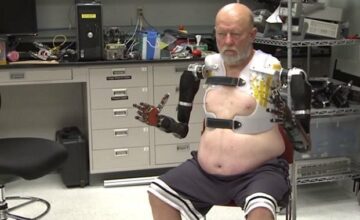 Première: des bras bioniques contrôlés par la pensée