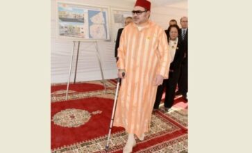 Le Roi Mohammed VI apparaît avec une béquille médicale