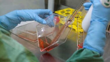 Virus Zika. Le plan d'action du ministère de la Santé