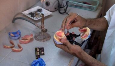 Reportage AFP. Au Maroc, faux dentistes mais vrais charlatans