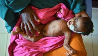 ONU: 20% de la population en Afrique souffre de faim