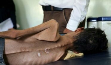 Yémen: L'Unicef appelle à l'arrêt des hostilités