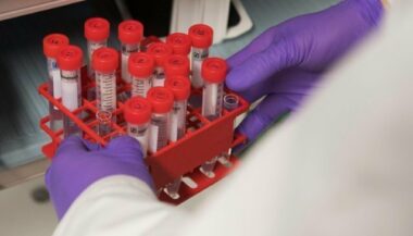 Cancers, diabètes, AVC: la bataille contre les maladies non transmissibles n'est pas gagnée
