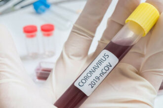 Covid. Le ministère de la Santé fixe un minimum de 18.500 tests à effectuer par jour