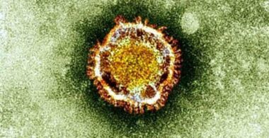 Coronavirus : le ministère de la santé élève le niveau de la surveillance épidémiologique