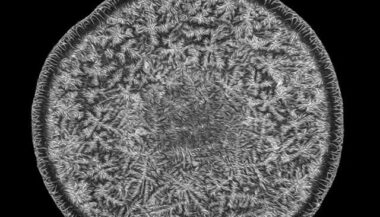 Voici à quoi ressemble une goutte de larme sous un microscope