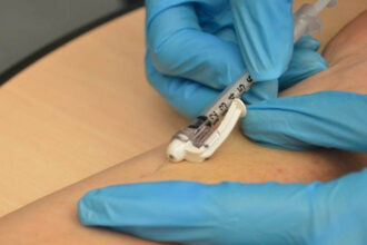 Les recommandations de l'ALCS pour améliorer l'accès au traitement de l'hépatite C