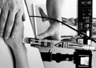 Le Maroc en manque de rhumatologues (étude AFLAR)