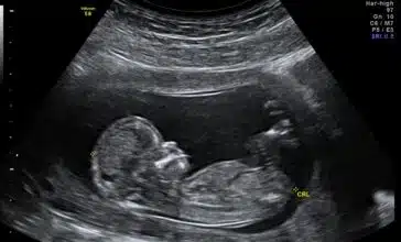 Une revue scientifique publie une étude confirmant la solution de la start-up DeepEcho