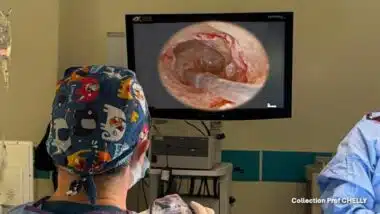 Première au Maroc, une implantation cochléaire réalisée sous guidage endoscopique