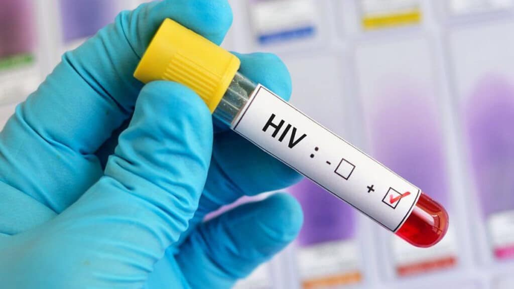 Environ 23.500 personnes vivent avec le VIH au Maroc