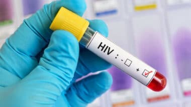 Approximately 23,500 people are living with HIV in Morocco